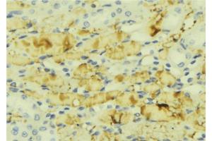 ABIN6276854 at 1/100 staining Mouse liver tissue by IHC-P. (MTTP 抗体  (Internal Region))