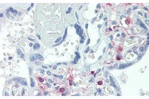 Detection of TRPC6 in Human Placenta Tissue using Polyclonal Antibody to Transient Receptor Potential Cation Channel Subfamily C, Member 6 (TRPC6)