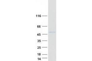 Western Blotting (WB) image for Cytochrome P450, Family 2, Subfamily D, Polypeptide 6 (CYP2D6) (Transcript Variant 2) protein (Myc-DYKDDDDK Tag) (ABIN2712768)