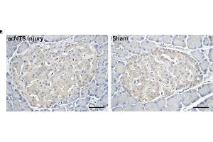 Changes in adrenal glands and pancreas in acNTS injured mice. (Insulin 抗体  (AA 46-59))