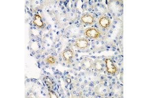Immunohistochemistry of paraffin-embedded rat kidney using RARRES2 antibody (ABIN5974187) at dilution of 1/200 (40x lens). (Chemerin 抗体)