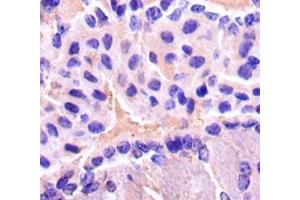 Immunohistochemistry of paraffin-embedded mouse brain tissue using ABIN7153540 at dilution of 1:50