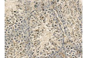DNAAF1 Mouse Monoclonal Antibody at 1/100 staining mouse testis tissue by IHC-P. (LRRC50 抗体)