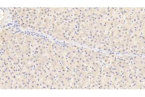 Detection of ROR1 in Human Liver Tissue using Polyclonal Antibody to Receptor Tyrosine Kinase Like Orphan Receptor 1 (ROR1)