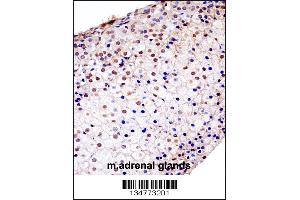 Immunohistochemistry (IHC) image for anti-Fibroblast Growth Factor Receptor 1 (FGFR1) (AA 756-784), (C-Term) antibody (ABIN5534378)