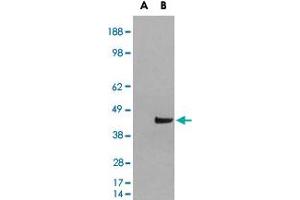 HEK293 overexpressing SNX16 and probed with SNX16 polyclonal antibody  (mock transfection in first lane), tested by Origene. (SNX16 抗体)