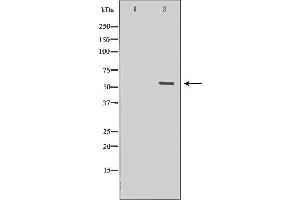 Western blot analysis of extracts of human heart tissue, using MYOC antibody. (MYOC 抗体  (Internal Region))