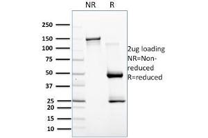 SDS-PAGE Analysis Purified CD257 Mouse Monoclonal Antibody (C257/1638). (BAFF 抗体)