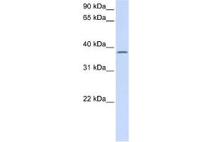 C21ORF91 antibody used at 1 ug/ml to detect target protein. (C21orf91 抗体  (Middle Region))