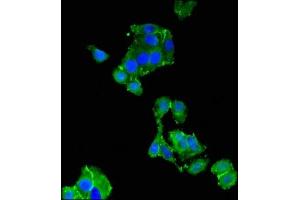 Immunofluorescent analysis of HepG2 cells using ABIN7173569 at dilution of 1:100 and Alexa Fluor 488-congugated AffiniPure Goat Anti-Rabbit IgG(H+L) (TNNC1 抗体  (AA 11-149))