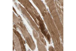 Immunohistochemical staining (Formalin-fixed paraffin-embedded sections) of human skeletal muscle with JPH1 polyclonal antibody  shows strong cytoplasmic positivity in myocytes. (Junctophilin 1 抗体  (AA 387-512))