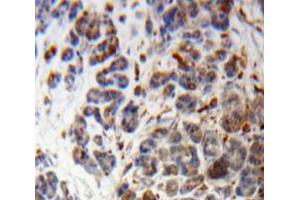 Used in DAB staining on fromalin fixed paraffin-embedded Pancreas tissue (POMC 抗体  (AA 23-267))