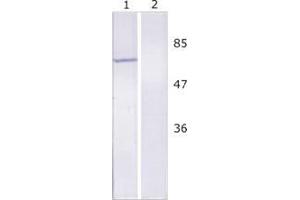 WB analysis of Huh-7 cell line expressing NS5B protein. (HCV 1b NS5B 抗体  (AA 92-105))