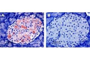 Immunohistochemistry (IHC) image for anti-Potassium Inwardly-Rectifying Channel, Subfamily J, Member 11 (KCNJ11) (AA 372-385), (Intracellular) antibody (ABIN7043473)