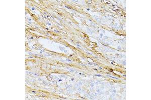 Immunohistochemistry (Paraffin-embedded Sections) (IHC (p)) image for anti-Transforming Growth Factor, beta-Induced, 68kDa (TGFBI) (AA 481-683) antibody (ABIN3023373)