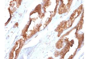 Formalin-fixed, paraffin-embedded human Prostate stained with HSP27 Mouse Monoclonal Antibody (CPTC-HSPB1-2). (HSP27 抗体)