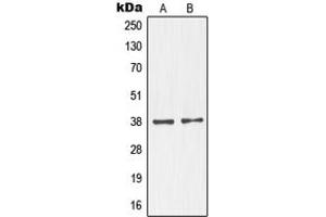 Western blot analysis of NKX2-1 expression in MAD109 (A), HeLa (B), SP2/0 (C) whole cell lysates. (NKX2-1 抗体  (N-Term))