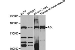 Western blot analysis of extracts of various cell lines, using AGL antibody (ABIN4902856) at 1:1000 dilution. (AGL 抗体)