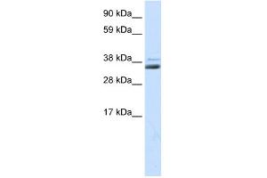 WB Suggested Anti-SFRP1 Antibody Titration:  0.