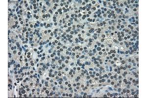 Immunohistochemical staining of paraffin-embedded Ovary tissue using anti-NEK6mouse monoclonal antibody. (NEK6 抗体)