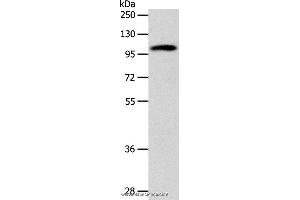 Western blot analysis of 293T cell, using ADCY1 Polyclonal Antibody at dilution of 1:1000 (ADCY1 抗体)