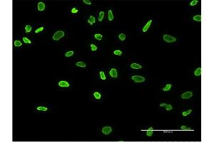 Immunofluorescence of monoclonal antibody to HNRNPA2B1 on HeLa cell. (HNRNPA2B1 抗体  (AA 1-249))