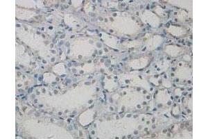 Immunohistochemical staining of formalin-fixed paraffin-embedded human kidney tissue showing cytoplasmic and nuclear staining with PAWR polyclonal antibody  at 1 : 100 dilution. (PAWR 抗体  (C-Term))