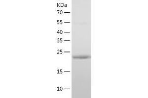 Western Blotting (WB) image for Mediator Complex Subunit 7 (MED7) (AA 1-233) protein (His tag) (ABIN7123874) (MED7 Protein (AA 1-233) (His tag))