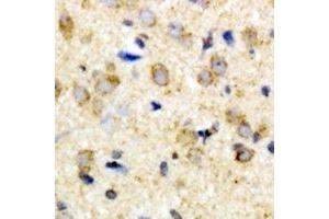 Immunohistochemical analysis of FIH-1 staining in rat brain formalin fixed paraffin embedded tissue section. (HIF1AN 抗体)