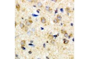 Immunohistochemical analysis of FIH-1 staining in rat brain formalin fixed paraffin embedded tissue section.