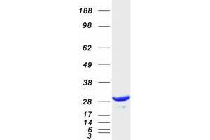 Western Blotting (WB) image for Proteasome (Prosome, Macropain) Activator Subunit 1 (PA28 Alpha) (PSME1) (Transcript Variant 1) protein (Myc-DYKDDDDK Tag) (ABIN2730009)
