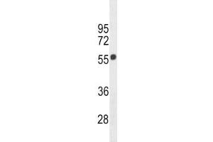 Cannabinoid Receptor 1 antibody western blot analysis in 293 lysate.