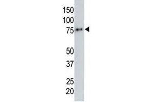 Anti-HA tag antibody testing a tagged recombinant protein. (HA-Tag 抗体)