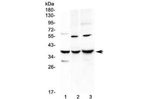 Western blot testing of 1) rat liver, 2) mouse Neuro-2a and 3) mouse HEPA1-6 lysate with IGFBP2 antibody at 0. (IGFBP2 抗体  (AA 35-304))