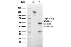SDS-PAGE Analysis of Purified Cadherin 16 Mouse Monoclonal Antibody (CDH16/2448). (Cadherin-16 抗体  (AA 371-507))