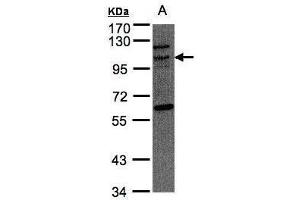 WB Image Sample(30 μg of whole cell lysate) A:Raji, 7. (TAO Kinase 3 抗体)