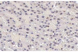Immunohistochemistry (IHC) image for anti-Signal Transducer and Activator of Transcription 5A (STAT5A) (pTyr694) antibody (ABIN6256791)