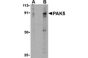 Western Blotting (WB) image for anti-P21 Protein (Cdc42/Rac)-Activated Kinase 7 (PAK7) (Middle Region) antibody (ABIN1031031) (PAK7 抗体  (Middle Region))