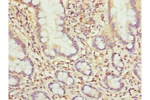 Immunohistochemistry of paraffin-embedded human small intestine tissue using ABIN7142439 at dilution of 1:100 (MRPL51 抗体  (AA 32-128))