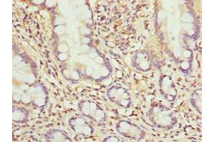 Immunohistochemistry of paraffin-embedded human small intestine tissue using ABIN7142439 at dilution of 1:100