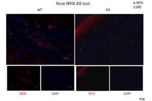 DG of Hippocampus   Dilution:  1:200 (NFIX 抗体  (Middle Region))