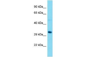 Western Blotting (WB) image for anti-Ribosomal RNA Processing 15 Homolog (RRP15) (Middle Region) antibody (ABIN2774509) (RRP15 抗体  (Middle Region))
