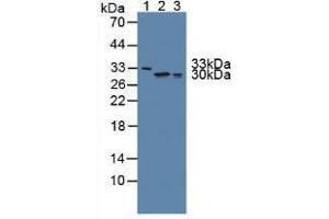 Western blot analysis of (1) Human Serum, (2) Human Lung Tissue and (3) Human A549 Cells. (FKBP7 抗体  (AA 24-217))