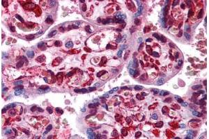 Human Placenta: Formalin-Fixed, Paraffin-Embedded (FFPE) (LIPG 抗体  (C-Term))