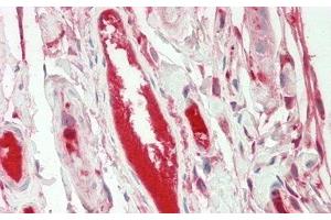 Immunohistochemistry (IHC) image for anti-Fibrinogen alpha Chain (FGA) (AA 124-214) antibody (ABIN7433189)