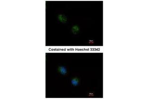 ICC/IF Image Immunofluorescence analysis of methanol-fixed A549, using STMN2, antibody at 1:500 dilution. (STMN2 抗体  (N-Term))