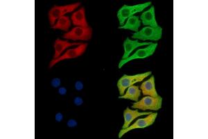 ABIN7097043 and ABIN7101110 staining Hela cells by IF/ICC. (COX18 抗体)