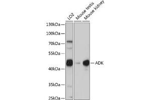 Western blot analysis of extracts of various cell lines, using ADK antibody (ABIN7265463) at 1:1000 dilution. (ADK 抗体  (AA 200-345))