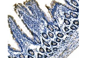 IHC analysis of Sigma1-Receptor/SIGMAR1 using anti-Sigma1-Receptor/SIGMAR1 antibody (ABIN7599011).
