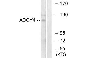 Western blot analysis of extracts from Jurkat cells, using ADCY4 antibody. (ADCY4 抗体  (Internal Region))